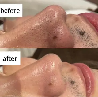 Binosu所属・エンダモロジー BINOSUのその他イメージ