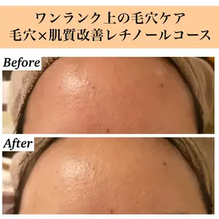 Bellesthe （ベルエステ）のエステ・リラクイメージ