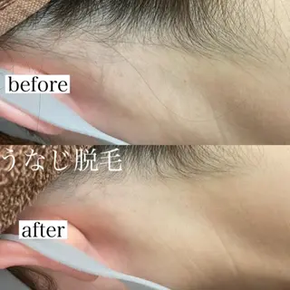 RinRin 甲府店のエステ・リラクイメージ