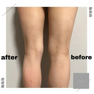 marron所属・痩身ハイパーナイフ ララピールリアボーテのエステ・リラクイメージ