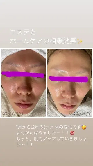 エル美容室所属・oshima yuukiのマツエク・マツパデザイン