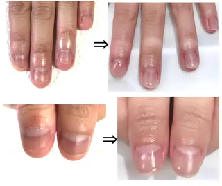 ネイル イワサキ  のネイルデザイン