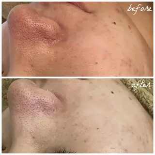 メンズ メナード岐阜市茜部 杉浦のエステ・リラクイメージ