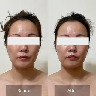 未病ケアサロン EMINY所属・未病ケアサロン EMINY☺︎勝俣のエステ・リラクイメージ