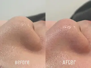 ニキビ・毛穴・肌荒れ &me 西宮北口店のその他イメージ