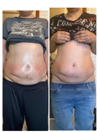 ミリ ミリのエステ・リラクイメージ