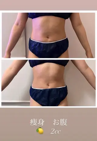 本気で痩せたい方へ 痩身専門サロンのエステ・リラクイメージ