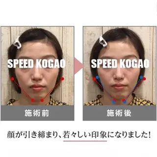 小顔矯正Speed KOGAO渋谷本店のエステ・リラクイメージ