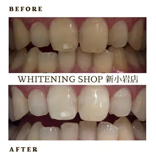 メンズ ホワイトニング ショップ新小岩店のその他イメージ