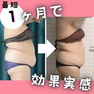 小顔矯正専門店 【RED】池田のエステ・リラクイメージ