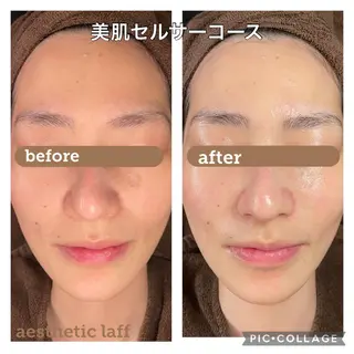 aesthetic laff所属・美肌作りのサロン 山村亜美のエステ・リラクイメージ