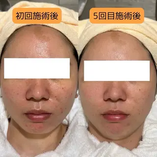 肌質改善美容サロン ému 用賀のエステ・リラクイメージ