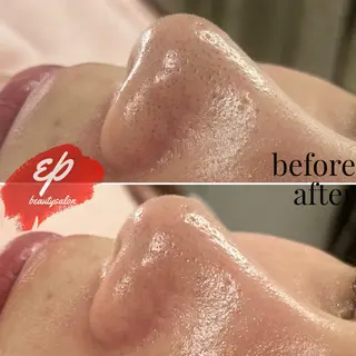 beauty salon  epのエステ・リラクイメージ