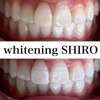 福岡ホワイトニング SHIRO天神店のエステ・リラクイメージ