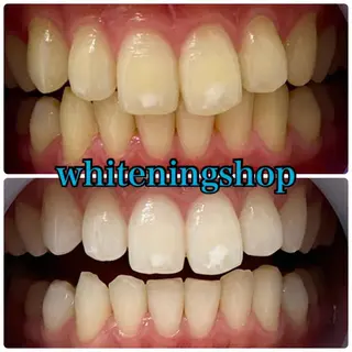 ホワイトニング ショップ吉祥寺店のエステ・リラクイメージ