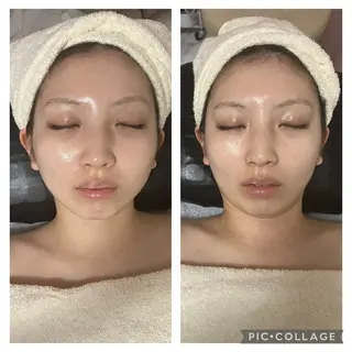 メディカルエステ 痩身·小顔専門サロンBBC 田園調布所属・KEI KOのエステ・リラクイメージ