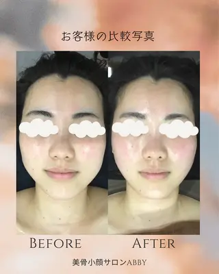 小顔コルギ💎 ABBY SANOのエステ・リラクイメージ