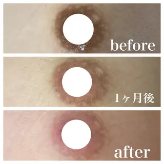 医療提携La Luna Keiのエステ・リラクイメージ