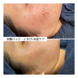 leolo武蔵浦和 肌質改善＆脱毛のエステ・リラクイメージ