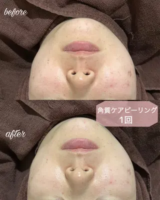 マツエク・マツパ merveilles所属・まつげ/整体/にきび ・アトピー専門サロンのマツエク・マツパデザイン