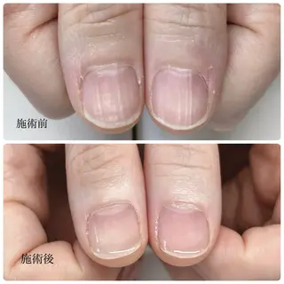 ネイル nailcare リリネルのネイルデザイン