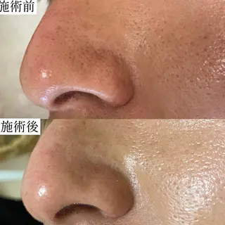 毛穴専門サロン　フルール所属・フルールFululu 自由が丘のエステ・リラクイメージ