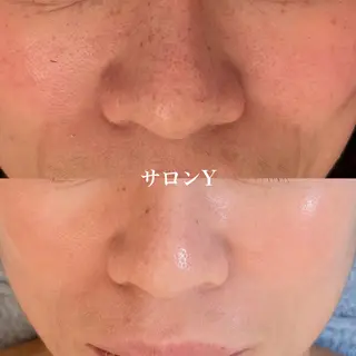 グリーンピール専門店 サロンY【大阪】のエステ・リラクイメージ