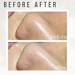 Beauty salon ハピー所属・大人女性のための 肌管理サロン　ハピーのエステ・リラクイメージ