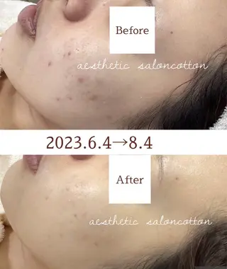 都度払い 肌質改善専門サロンのエステ・リラクイメージ