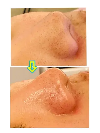 ビューティアス〜Beautyus〜所属・山田 美夕紀のエステ・リラクイメージ