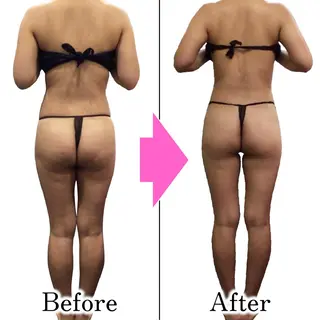 ダイエットラボ梅田店 🌟のエステ・リラクイメージ