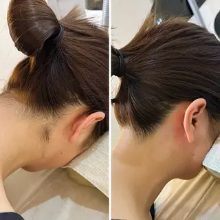 うなじ脱毛/美肌脱毛 LABELのエステ・リラクイメージ