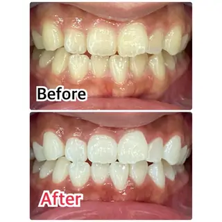 ネイル マツエク・マツパ アイブロウ プラチナムビューティー柏所属・【歯科提携】柏ホワイ トニングスタイルのその他イメージ