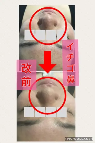 メンズ 四つ星サロン🎖 腸＆ニキビケアに特化のエステ・リラクイメージ