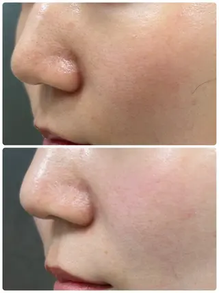 艶肌/角質ケア フェイシャルワックスのエステ・リラクイメージ