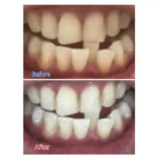 M渋谷店所属・Ｍ渋谷 ホワイトニングのその他イメージ