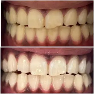 セルフホワイトニングサロンエクシアホワイト倉敷店所属・ecxiawhite 倉敷店のエステ・リラクイメージ