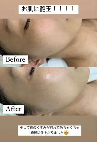 デ・アイム新潟　　北所属・山口 萌のエステ・リラクイメージ