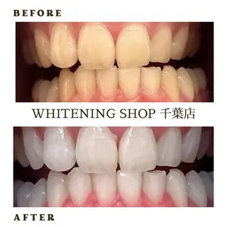 メンズ ホワイトニング ショップ千葉店のその他イメージ