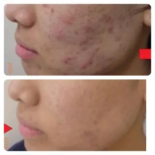 肌質改善専門 鈴木悠のエステ・リラクイメージ