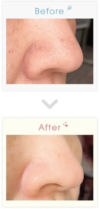 シミケア＆脱毛サロン CHANCEのエステ・リラクイメージ