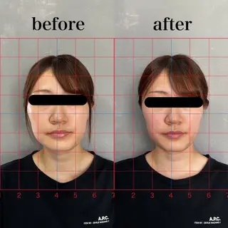 そノさき所属・鍼灸整体専門サロン 島袋のエステ・リラクイメージ