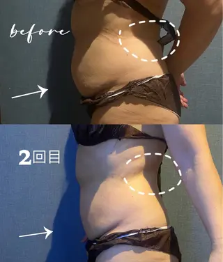 🧚‍♀️優来 リラク痩身肌質改善のエステ・リラクイメージ