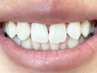 セルフホワイトニングサロン　ラヴィアン所属・ホワイトニングサロン La vie enのその他イメージ