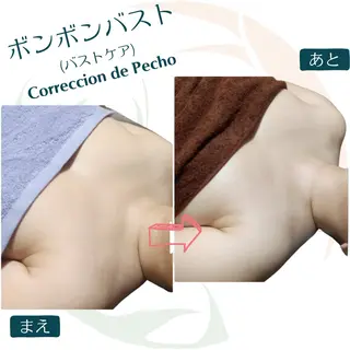 小顔矯正☀︎バスト ☀︎ハルのエステ・リラクイメージ