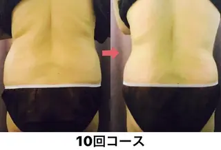 横浜エステサロン R-ing　リングのエステ・リラクイメージ