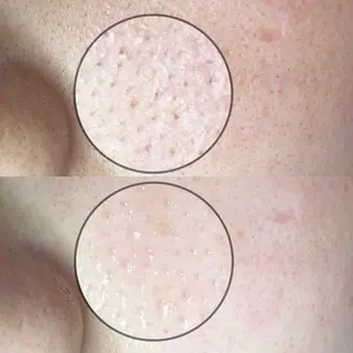 毛穴専門店MeMe.八千代店所属・\毛穴・頭皮/ のお悩みに特化💪のその他イメージ