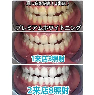 プラチナムビューティー柏所属・【歯科提携】柏ホワイ トニングスタイルのその他イメージ