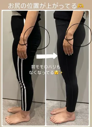 クラスペディア脱毛 ・フェイシャル専門店のエステ・リラクイメージ