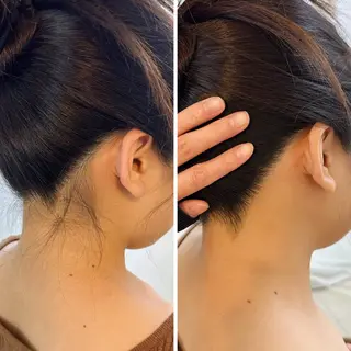 うなじ脱毛/美肌脱毛 LABELのエステ・リラクイメージ